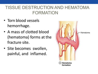 TISSUE DESTRUCTION AND HEMATOMA
FORMATION
• Torn blood vessels
hemorrhage.
• A mass of clotted blood
(hematoma) forms at the
fracture site.
• Site becomes swollen,
painful, and inflamed.
 
