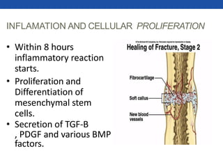INFLAMATION AND CELLULAR PROLIFERATION
• Within 8 hours
inflammatory reaction
starts.
• Proliferation and
Differentiation of
mesenchymal stem
cells.
• Secretion of TGF-B
, PDGF and various BMP
factors.
 