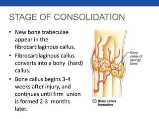 STAGE OF CONSOLIDATION
• New bone trabeculae
appear in the
fibrocartilaginous callus.
• Fibrocartilaginous callus
converts into a bony (hard)
callus.
• Bone callus begins 3-4
weeks after injury, and
continues until firm union
is formed 2-3 months
later.
 