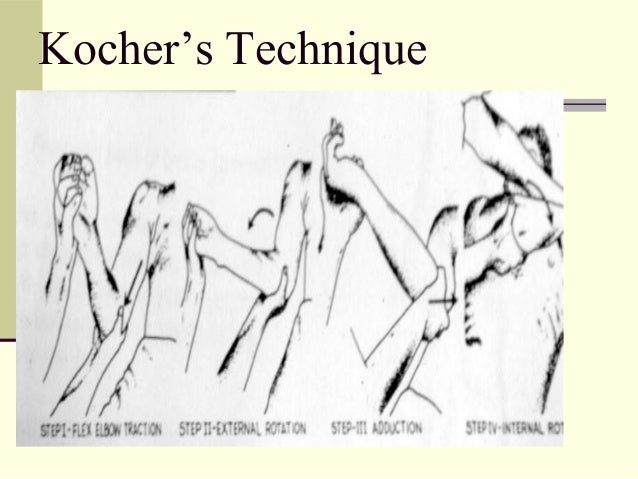 Fractures And Dislocations Upper Limb