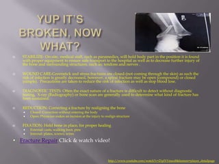    STABILIZE- On-site, medical staff, such as paramedics, will hold body part in the position it is found
    with proper equipment to ensure safe transport to the hospital as well as to decrease further injury of
    the bone and surrounding structures, such as; tendons and nerves .

   WOUND CARE-Greenstick and stress fractures are closed-(not coming through the skin) as such the
    risk of infection is greatly decreased, however, a spiral fracture may be open (compound) or closed
    (simple). Precautions are taken to reduce the risk of infection as well as stop blood lose.

   DIAGNOSTIC TESTS: Often the exact nature of a fracture is difficult to detect without diagnostic
    testing, X-ray (Radiography) or bone scan are generally used to determine what kind of fracture has
    been sustained.

   REDUCTION: Correcting a fracture by realigning the bone
       Closed: Correction without entering the body
       Open: Physician makes an incision at the injury to realign structure

   FIXATION: Hold bone in place, for proper healing
       External: casts, walking boot, pins
       Internal: plates, screws, wires

• Fracture Repair Click & watch video!


                                                             http://www.youtube.com/watch?v=21plYYmaxi8&feature=player_detailpage
 