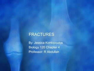 FRACTURES	 By: Jessica Kontopoulos Biology 120 Chapter 4 Professor: R Abdullah 