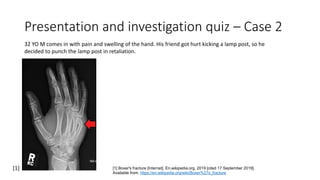 Presentation and investigation quiz – Case 2
32 YO M comes in with pain and swelling of the hand. His friend got hurt kicking a lamp post, so he
decided to punch the lamp post in retaliation.
[1] Boxer's fracture [Internet]. En.wikipedia.org. 2019 [cited 17 September 2019].
Available from: https://en.wikipedia.org/wiki/Boxer%27s_fracture
[1]
 