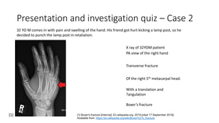 Presentation and investigation quiz – Case 2
32 YO M comes in with pain and swelling of the hand. His friend got hurt kicking a lamp post, so he
decided to punch the lamp post in retaliation.
X ray of 32YOM patient
Boxer’s fracture
[1] Boxer's fracture [Internet]. En.wikipedia.org. 2019 [cited 17 September 2019].
Available from: https://en.wikipedia.org/wiki/Boxer%27s_fracture
[1]
PA view of the right hand
Transverse fracture
Of the right 5th metacarpal head.
With a translation and
?angulation
 