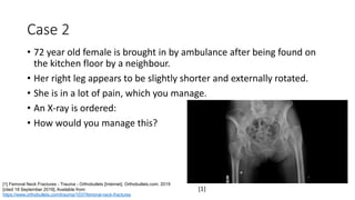 Case 2
• 72 year old female is brought in by ambulance after being found on
the kitchen floor by a neighbour.
• Her right leg appears to be slightly shorter and externally rotated.
• She is in a lot of pain, which you manage.
• An X-ray is ordered:
• How would you manage this?
[1] Femoral Neck Fractures - Trauma - Orthobullets [Internet]. Orthobullets.com. 2019
[cited 18 September 2019]. Available from:
https://www.orthobullets.com/trauma/1037/femoral-neck-fractures
[1]
 