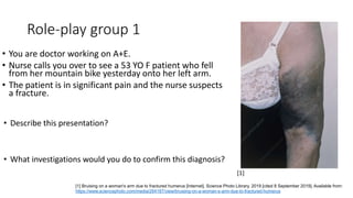 Role-play group 1
• You are doctor working on A+E.
• Nurse calls you over to see a 53 YO F patient who fell
from her mountain bike yesterday onto her left arm.
• The patient is in significant pain and the nurse suspects
a fracture.
• Describe this presentation?
• What investigations would you do to confirm this diagnosis?
[1] Bruising on a woman's arm due to fractured humerus [Internet]. Science Photo Library. 2019 [cited 8 September 2019]. Available from:
https://www.sciencephoto.com/media/264187/view/bruising-on-a-woman-s-arm-due-to-fractured-humerus
[1]
 