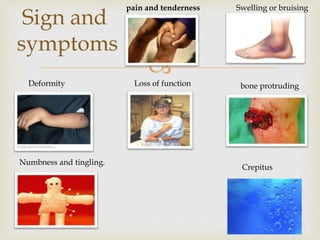 
Sign and
symptoms
pain and tenderness Swelling or bruising
Deformity Loss of function bone protruding
Numbness and tingling.
Crepitus
 