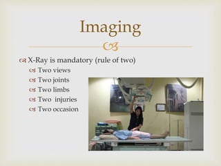
 X-Ray is mandatory (rule of two)
 Two views
 Two joints
 Two limbs
 Two injuries
 Two occasion
Imaging
 