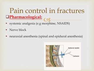 
Pain control in fractures
Pharmacological:
 systemic analgesia (e.g morphine, NSAIDS)
 Nerve block
 neuraxial anesthesia (spinal and epidural anesthesia)
 