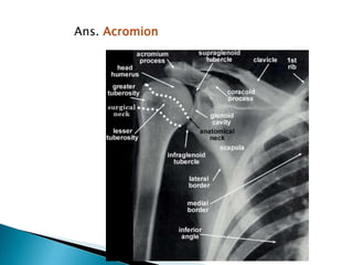 Fractures and dislocations- Upper Limb | PDF