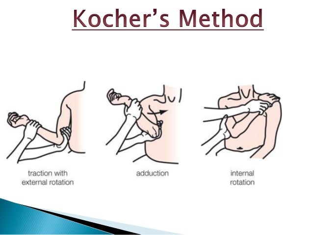 Fractures and dislocations- Upper Limb