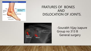FRATURES OF BONES
AND
DISLOCATION OF JOINTS.
-Sourabh Vijay isapure
Group no 313 B
General surgery
 