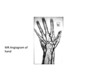 Fractures and dislocations of hand | PPTX