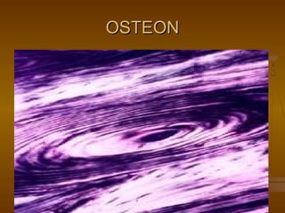OSTEONOSTEON
 