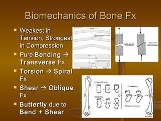 Biomechanics of Bone FxBiomechanics of Bone Fx
 Weakest inWeakest in
Tension, StrongestTension, Strongest
in Compressionin Compression
 PurePure BendingBending 
TransverseTransverse FxFx
 TorsionTorsion  SpiralSpiral
FxFx
 ShearShear  ObliqueOblique
FxFx
 ButterflyButterfly due todue to
Bend + ShearBend + Shear
 