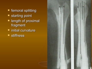  femoral splittingfemoral splitting
 starting pointstarting point
 length of proximallength of proximal
fragmentfragment
 initial curvatureinitial curvature
 stiffnessstiffness
 