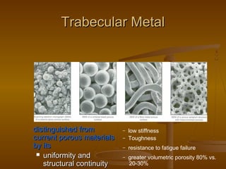 Trabecular MetalTrabecular Metal
distinguished fromdistinguished from
current porous materialscurrent porous materials
by itsby its
 uniformity anduniformity and
structural continuitystructural continuity
– low stiffness
– Toughness
– resistance to fatigue failure
– greater volumetric porosity 80% vs.
20-30%
 