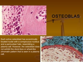 OSTEOBLAS
T
Each active osteoblast has eccentrically
located nuclei with a conspicuous nucleus
and a perinuclear halo, resembling a
plasma cell. However, the osteoblast does
not exhibit the clock-face or wheel-like
chromatin pattern that is seen in a plasma
cell.
 