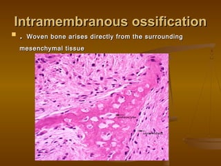 Intramembranous ossificationIntramembranous ossification
 .. Woven bone arises directly from the surroundingWoven bone arises directly from the surrounding
mesenchymal tissuemesenchymal tissue
 