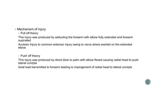  Mechanism of injury
 Pull off theory
This injury was produced by adducting the forearm with elbow fully extended and forearm
supinated
Avulsion Injury to common extensor injury owing to varus stress exerted on the extended
elbow
 Push off theory
This injury was produced by direct blow to palm with elbow flexed causing radial head to push
lateral condyle
Axial load transmitted to forearm leading to impingement of radial head to lateral condyle
 