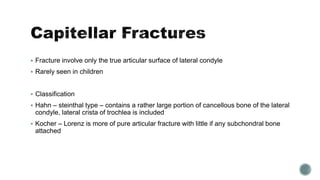  Fracture involve only the true articular surface of lateral condyle
 Rarely seen in children
 Classification
 Hahn – steinthal type – contains a rather large portion of cancellous bone of the lateral
condyle, lateral crista of trochlea is included
 Kocher – Lorenz is more of pure articular fracture with little if any subchondral bone
attached
 