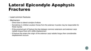  Least common fractures
 Mechanism
 Direct blow to lateral condyle of elbow
 Sometimes in children avulsion forces from the extensor muscles may be responsible for
these injuries
 If the proximal part of fracture line lies between common extensors and extensor carpi
radialis longus there eill b elittle displacement
 If fracture line enters the origin of the extensor carpi radialis longus then considerable
displacement occcurs
 