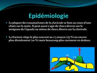 Epidémiologie
 La plupart des traumatismes de la clavicule se font au cours d'une
chute sur la main. Il peut aussi s'agir de chocs directs sur le
moignon de l'épaule ou même de chocs directs sur la clavicule.
 La fracture siège le plus souvent au 1/3 moyen (75 %) ou encore
plus distalement (20 %) mais beaucoup plus rarement en dedans.
 