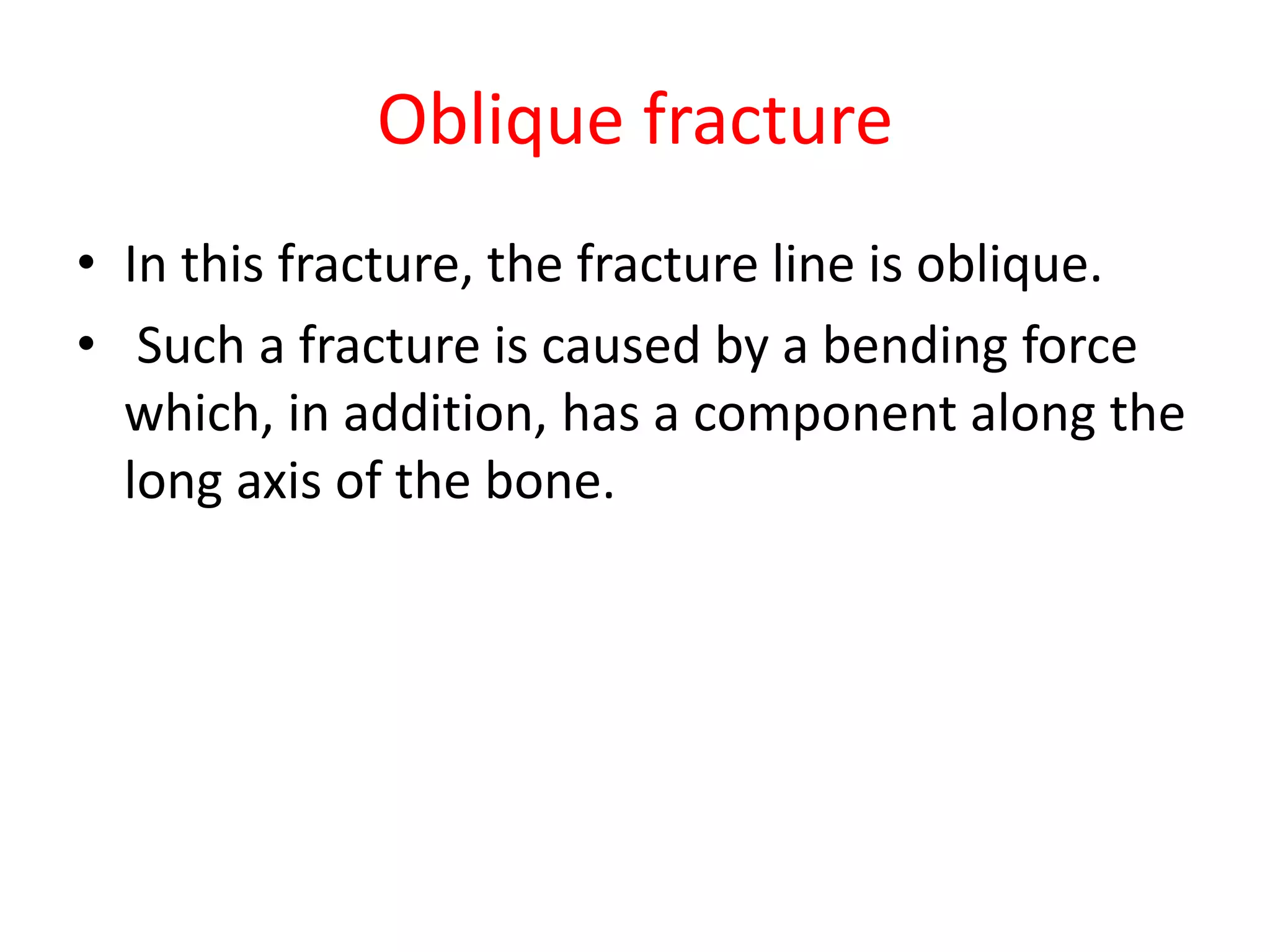Oblique fracture
• In this fracture, the fracture line is oblique.
• Such a fracture is caused by a bending force
which, in addition, has a component along the
long axis of the bone.
 