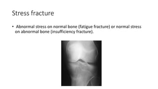 Fracture classification | PPTX