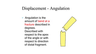 Fracture classification | PPTX
