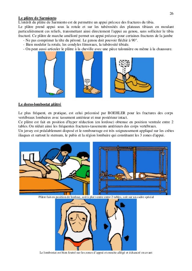Fractures generalites
