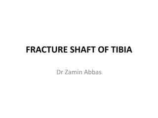 FRACTURE SHAFT OF TIBIA
Dr Zamin Abbas
 