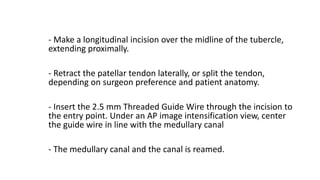 - Make a longitudinal incision over the midline of the tubercle,
extending proximally.
- Retract the patellar tendon laterally, or split the tendon,
depending on surgeon preference and patient anatomy.
- Insert the 2.5 mm Threaded Guide Wire through the incision to
the entry point. Under an AP image intensification view, center
the guide wire in line with the medullary canal
- The medullary canal and the canal is reamed.
 