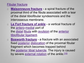 FRACTURE (Sites) | PPTX