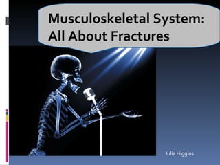 Musculoskeletal System: All About Fractures Julia Higgins 