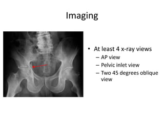 Imaging
• At least 4 x-ray views
– AP view
– Pelvic inlet view
– Two 45 degrees oblique
view
 