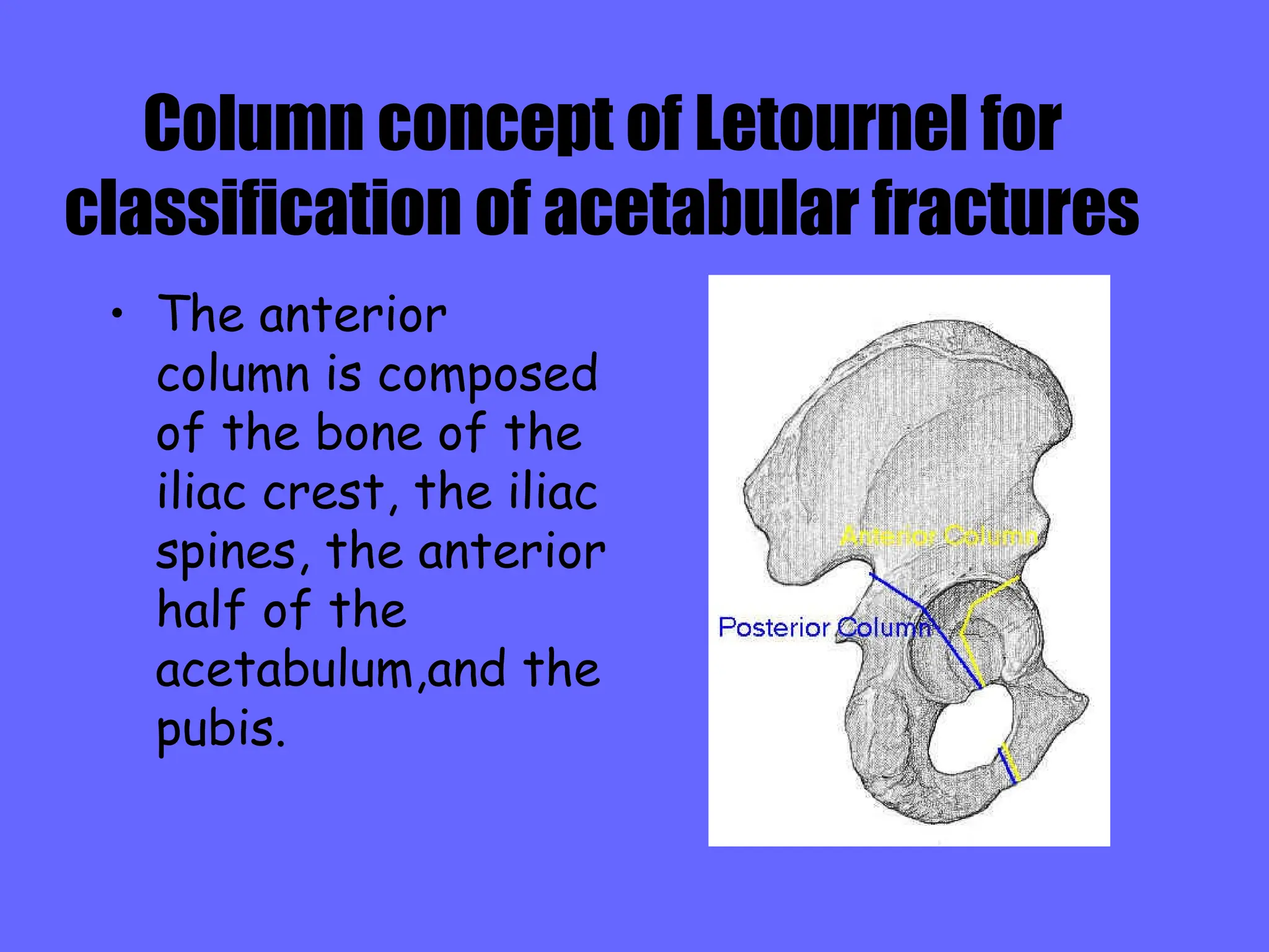 Fractures Of Acetabulum Ppt Fractures Around Hip Ppt