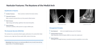 Navicular Keystone Comprehensive Overview of Small Bone Fractures in the Foot: Diagnosis ...