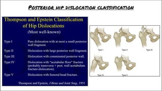 FRACTURES OF LOWER LIMB 1.pdf