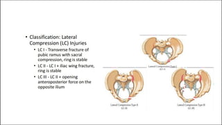FRACTURES OF LOWER LIMB 1.pdf