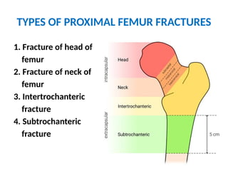 FRACTURES OF PROXIMAL FEMUR ORTHOPEDICS.pptx
