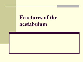 Fractures of the acetabulum 