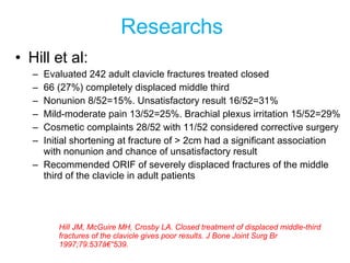 Researchs   <ul><li>Hill et al:  </li></ul><ul><ul><li>Evaluated 242 adult clavicle fractures treated closed </li></ul></u...