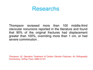 Researchs   <ul><li>Thompson reviewed more than 100 middle-third clavicular nonunions reported in the literature and found...