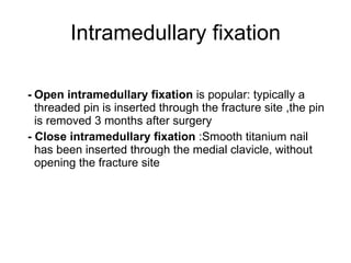 <ul><li>- Open intramedullary fixation  is popular: typically a threaded pin is inserted through the fracture site ,the pi...
