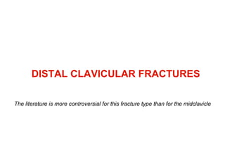 DISTAL CLAVICULAR FRACTURES The literature is more controversial for this fracture type than for the midclavicle 