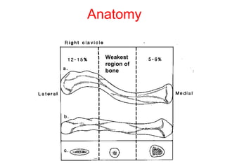 Anatomy Weakest region of bone 
