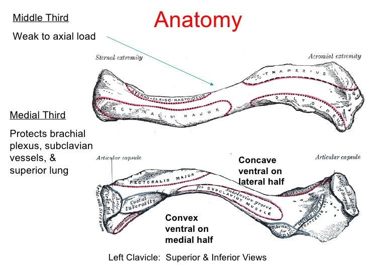 Fractures of the clavicle