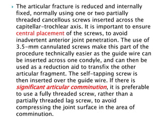 Transfixed Self Fractures of the distal humerus ppt | PPTX