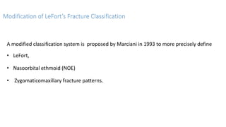 Fractures of the Middle-third of the Facial Skeleton (1).pptx